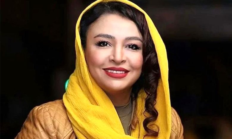 رونمایی خانم بازیگر از شمایل جدیدش+ عکس