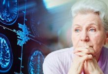وقتی آلودگی هوا ذهن را نشانه می‌گیرد / ارتباط نگران‌کننده آلودگی هوا با زوال عقل