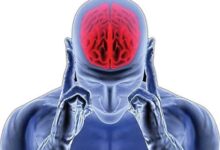 علائم اولیه آلزایمر و راهکارهایی برای همراهی با مبتلایان