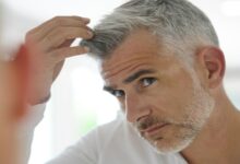 خاکستری شدن موها