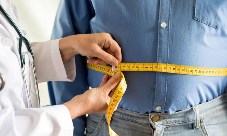 جراحی کاهش وزن