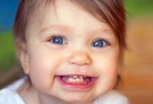 حقیقتی که شما را شوکه می کند؛ استرس بارداری به دندان های نوزاد سرایت می کند!