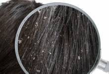 اگر شوره دارید، شب‌ها این کار ساده را فراموش نکنید!