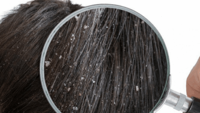 اگر شوره دارید، شبها این کار ساده را فراموش نکنید!