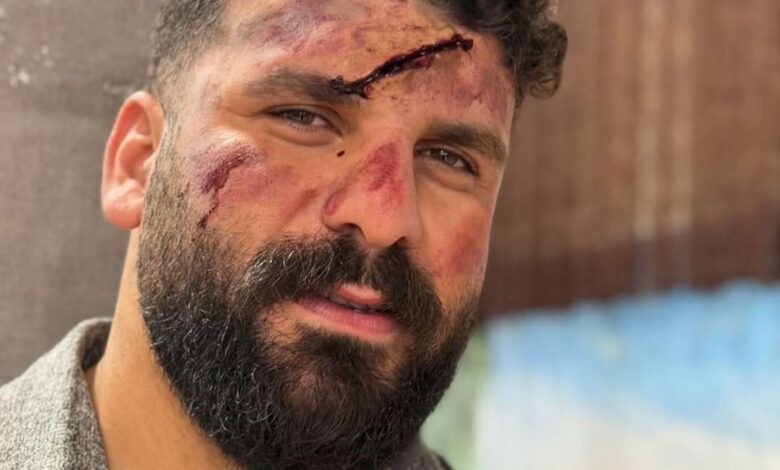 حادثه کوهستانی برای بلاگر شناختهشده ایرانی